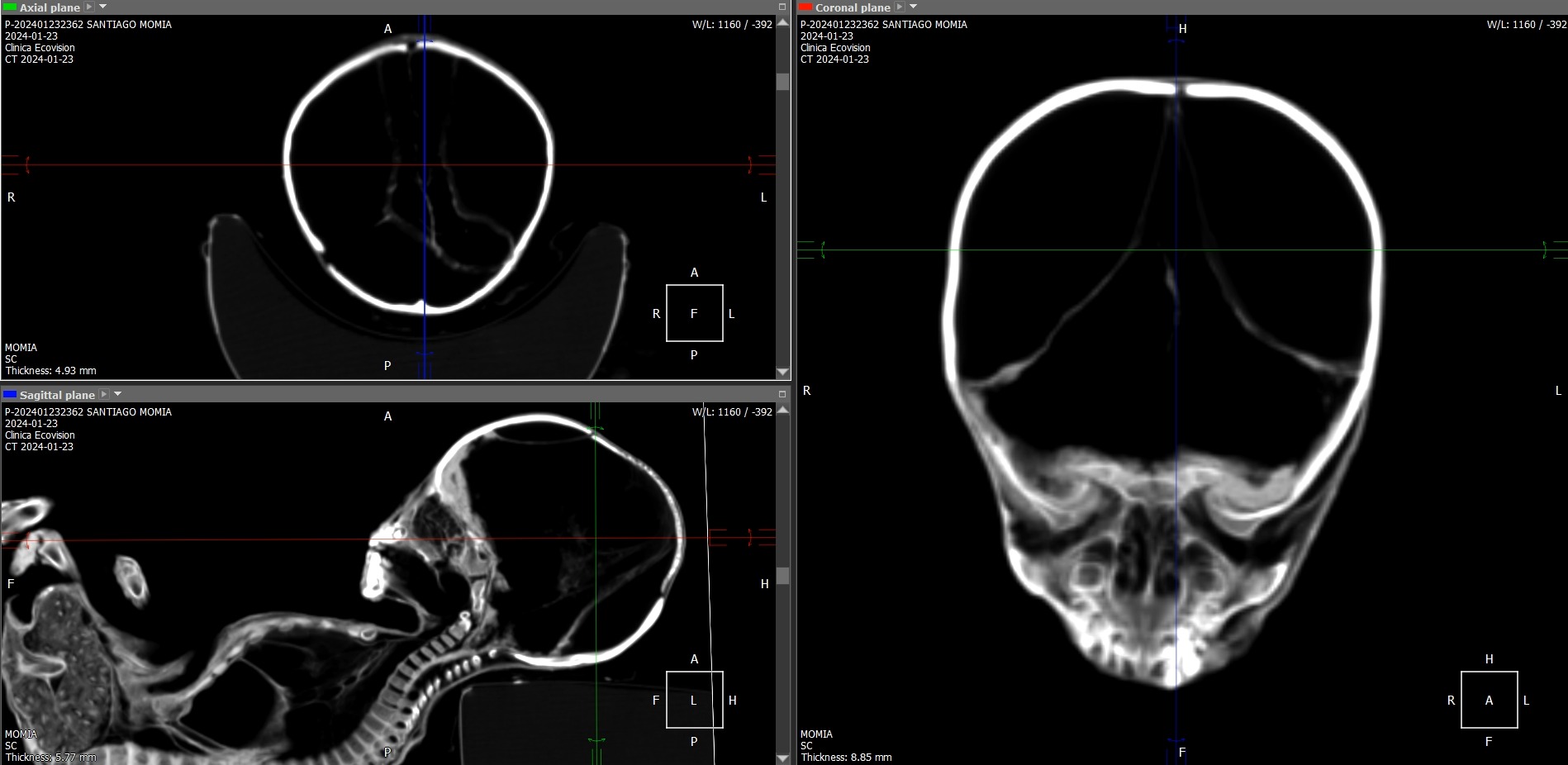 Medical Scan of Santiago